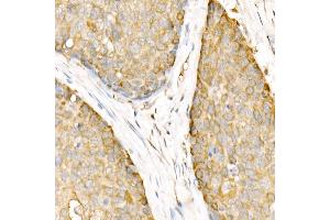 Immunohistochemistry of paraffin-embedded rat brain using DNA Ligase III/LIG3 Rabbit pAb (ABIN6130288, ABIN6143207, ABIN6143208 and ABIN6217532) at dilution of 1:50 (40x lens).