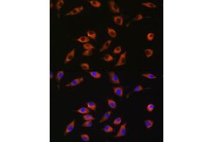Immunofluorescence analysis of L929 cells using SYT12 antibody (ABIN7270678) at dilution of 1:100. (SYT12 anticorps  (AA 95-200))