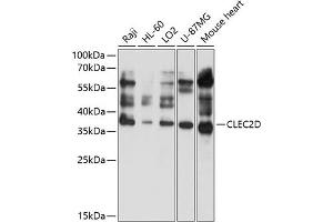 Western blot analysis of extracts of various cell lines, using CLEC2D antibody (ABIN6130113, ABIN6138707, ABIN6138708 and ABIN6214667) at 1:1000 dilution. (CLEC2D anticorps  (AA 60-154))