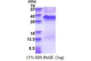SDS-PAGE (SDS) image for Signal Sequence Receptor, alpha (SSR1) (AA 22-207) protein (His tag) (ABIN6387332)