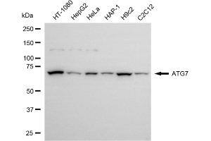 Western blotting analysis using ATG7 antibody (ABIN7797676).