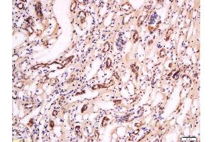 Formalin-fixed and paraffin embedded human kidney labeled with Anti- Pan FOXD Polyclonal Antibody, Unconjugated  at 1:200 followed by conjugation to the secondary antibody and DAB staining. (FOXD (AA 131-230) anticorps)