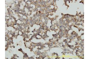 Immunoperoxidase of monoclonal antibody to RRAS2 on formalin-fixed paraffin-embedded human dysgerminoma tissue.