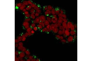 anti-Cathepsin D (CTSD) (AA 104-250) antibody