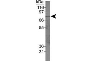 Western blot analysis of ACSL1 in HepG2 whole cell lysates using ACSL1 polyclonal antibody . (ACSL1 anticorps  (AA 1-100))