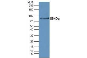 Rabbit Capture antibody from the kit in WB with Positive Control: Mouse liver tissue.