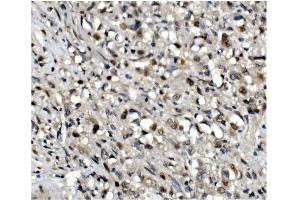 IHC analysis of OGT using anti-OGT antibody (ABIN3043893). (OGT anticorps  (C-Term))