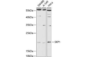 Western blot analysis of extracts of various cell lines, using SKP1 antibody (ABIN6130683, ABIN6147817, ABIN6147819 and ABIN6216158) at 1:1000 dilution. (SKP1 anticorps  (AA 1-163))