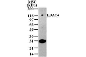 HDAC4 antibody (pAb) tested by Western blot. (HDAC4 anticorps  (AA 194-209))