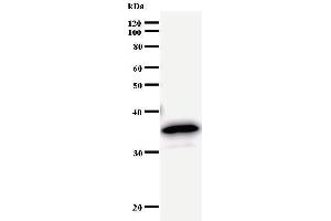 Western Blotting (WB) image for anti-Bromodomain Containing 3 (BRD3) antibody (ABIN933105)