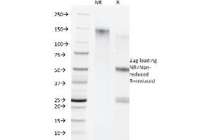 anti-Keratin 5/8 (KRT5/8) antibody