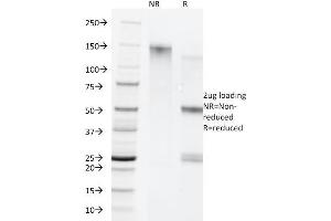 SDS-PAGE Analysis Purified Cytokeratin 5/8 Monoclonal Antibody (C-50). (Keratin 5/8 anticorps)