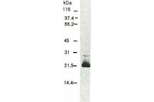 Western Blotting (WB) image for anti-Hepatitis C Virus Core Protein (HCV C) (AA 13-124), (AA 369-704) antibody (FITC) (ABIN2451998)
