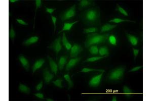 Immunofluorescence of monoclonal antibody to TYMS on HeLa cell.