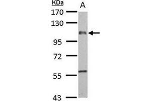 AP31133PU-N EMR1 antibody staining of Rat liver extract (Lane A), (50 µg/extract) at 1/1000 dilution, 7.