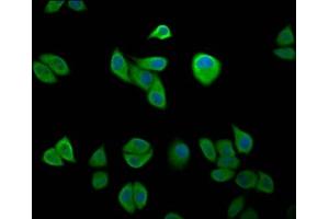 Immunofluorescence staining of Hela cells with ABIN7151572 at 1:200, counter-stained with DAPI. (IKAP/p150 anticorps  (AA 1107-1258))