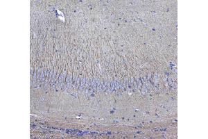 IHC analysis of GSTM3 using anti-GSTM3 antibody .