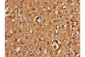 Immunohistochemistry of paraffin-embedded human brain tissue using ABIN7170654 at dilution of 1:100