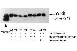 Image no. 1 for anti-Mast/stem Cell Growth Factor Receptor (KIT) (pTyr721) antibody (ABIN196993) (KIT anticorps  (pTyr721))