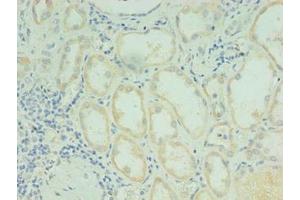 Immunohistochemistry of paraffin-embedded human kidney tissue using ABIN7167836 at dilution of 1:100 (RDH12 anticorps  (AA 1-316))