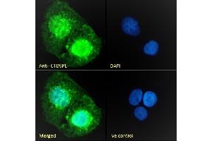 (ABIN263205) Immunofluorescence analysis of paraformaldehyde fixed A431 cells, permeabilized with 0. (CTDSPL anticorps  (Internal Region))
