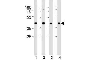 Western blot analysis of lysate from (1) HeLa, (2) U-87 MG, (3) rat C6 cell line and (4) mouse heart tissue lysate using Connexin 43 antibody at 1:1000. (Connexin 43/GJA1 anticorps  (AA 107-138))