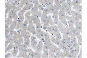 IHC-P analysis of Human Liver Tissue, with DAB staining. (ARPC4 anticorps  (AA 3-165))