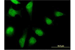Immunofluorescence of monoclonal antibody to PFDN2 on HeLa cell. (PFDN2 anticorps  (AA 1-154))
