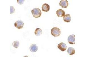 Immunocytochemistry of caspase-6 in MCF7 with AP30201PU-N caspase-6 antibody at 1 μg/ml.