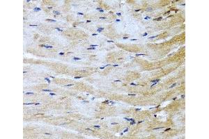 Immunohistochemistry of paraffin-embedded Mouse heart using M6PR Polyclonal Antibody at dilution of 1:100 (40x lens). (M6PR anticorps)