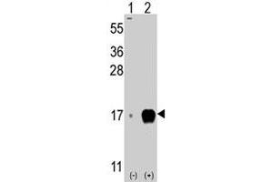 Western blot analysis of IFITM3 (arrow) using rabbit IFITM3 polyclonal antibody . (IFITM3 anticorps  (Internal Region))