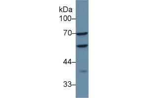 Detection of CAP1 in Human HepG2 cell lysate using Polyclonal Antibody to Adenylyl Cyclase Associated Protein 1 (CAP1) (CAP1 anticorps  (AA 38-149))