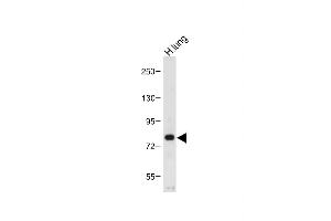 Anti-MUC20 Antibody (C-term) at 1:1000 dilution + Human lung tissue lysate Lysates/proteins at 20 μg per lane. (MUC20 anticorps  (C-Term))
