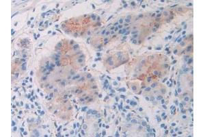 Detection of Slit1 in Human Stomach Tissue using Polyclonal Antibody to Slit Homolog 1 (Slit1)