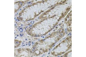 Immunohistochemistry of paraffin-embedded human stomach using MAPK1 antibody.