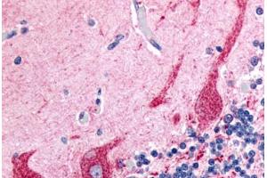 Human Brain, Cerebellum (formalin-fixed, paraffin-embedded) stained with PRKCZ antibody ABIN213577 at 2.