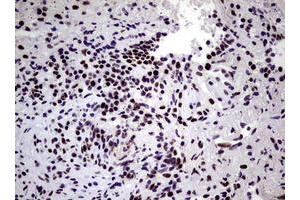 Image no. 2 for anti-Nibrin (NBN) (AA 183-460) antibody (ABIN1491066)