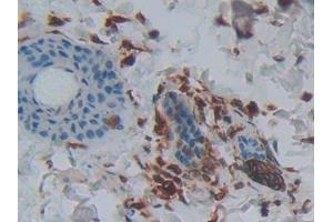 DAB staining on IHC-P; Samples: Rat Skin Tissue (PLA2G2A anticorps  (AA 22-146))