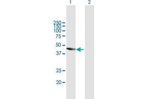 Western Blot analysis of TBC1D16 expression in transfected 293T cell line by TBC1D16 MaxPab polyclonal antibody. (TBC1D16 anticorps  (AA 1-405))