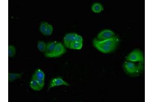 Immunofluorescent analysis of MCF-7 cells using ABIN7149438 at dilution of 1:100 and Alexa Fluor 488-congugated AffiniPure Goat Anti-Rabbit IgG(H+L)