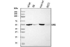 Western blot analysis of ADRB1 using anti-ADRB1 antibody (ABIN7602843).