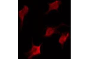 ABIN6275979 staining COLO205 by IF/ICC. (CasLTR2 anticorps  (Internal Region))