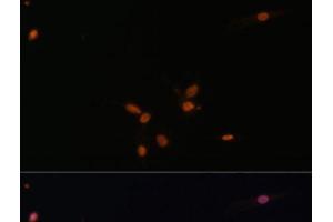 Immunofluorescence analysis of C6 cells using SMAD7 Polyclonal Antibody at dilution of 1:100. (SMAD7 anticorps)