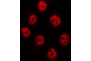 ABIN6267621 staining A431 by IF/ICC.