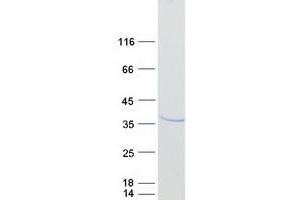 Validation with Western Blot