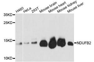 Western blot analysis of extracts of various cell lines, using NDUFB2 antibody. (NDUFB2 anticorps  (AA 34-105))