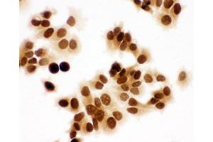 Anti-MCM7 antibody, ICC ICC: MCF-7 Cell