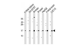All lanes : Anti-Autophagy GABAR Antibody (N-term) at 1:1000-1 :2000 dilution Lane 1: human fetal kidney lysate Lane 2: SH-SY5Y whole cell lysate Lane 3: mouse brain lysate Lane 4: rat brain whole cell lysate Lane 5: HepG2 whole cell lysate Lane 6: human fetal brain lysate Lane 7: C2C12 whole cell lysate Lysates/proteins at 20 μg per lane. (GABARAP anticorps  (AA 1-30))
