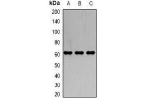 Western blot analysis of IRSp53 expression in A549 (A), K562 (B), SW620 (C) whole cell lysates. (BAIAP2 anticorps)