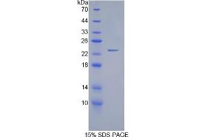 SDS-PAGE of Protein Standard from the Kit  (Highly purified E. (GREM1 Kit ELISA)